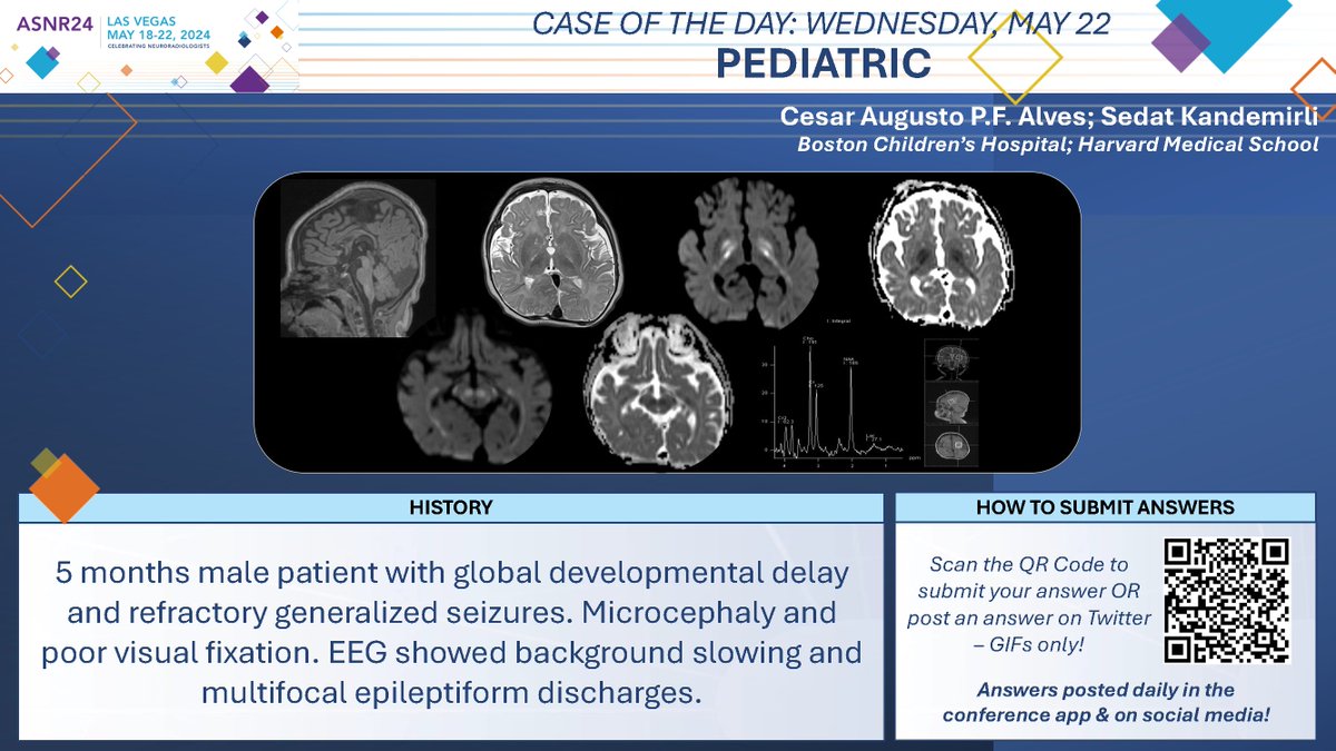 #ASNR24 #COTD: Wednesday Pediatric Thx to Drs. Cesar Augusto P.F. Alves and Sedat Kandemirli NO SPOILERS!!! Give answers as GIFs ONLY. Submit answers for a chance to win prizes! Answer tomorrow morning. #ASNR24 #Neuroradiology #FOAMed #RadRes #MedEd