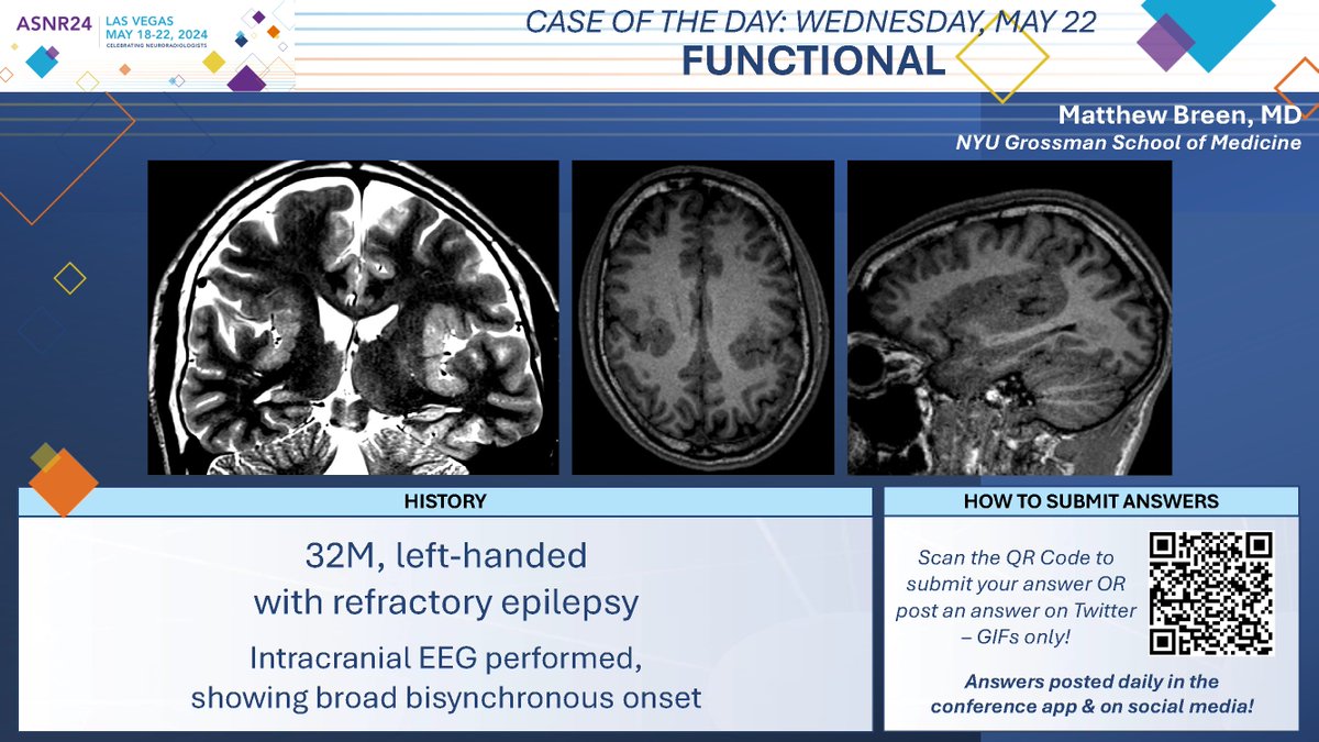 #ASNR24 #COTD: Wednesday Functional Thx to Dr. Matthew Breen NO SPOILERS!!! Give answers as GIFs ONLY. Submit answers for a chance to win prizes! Answer tomorrow morning. #ASNR24 #Neuroradiology #FOAMed #RadRes #MedEd