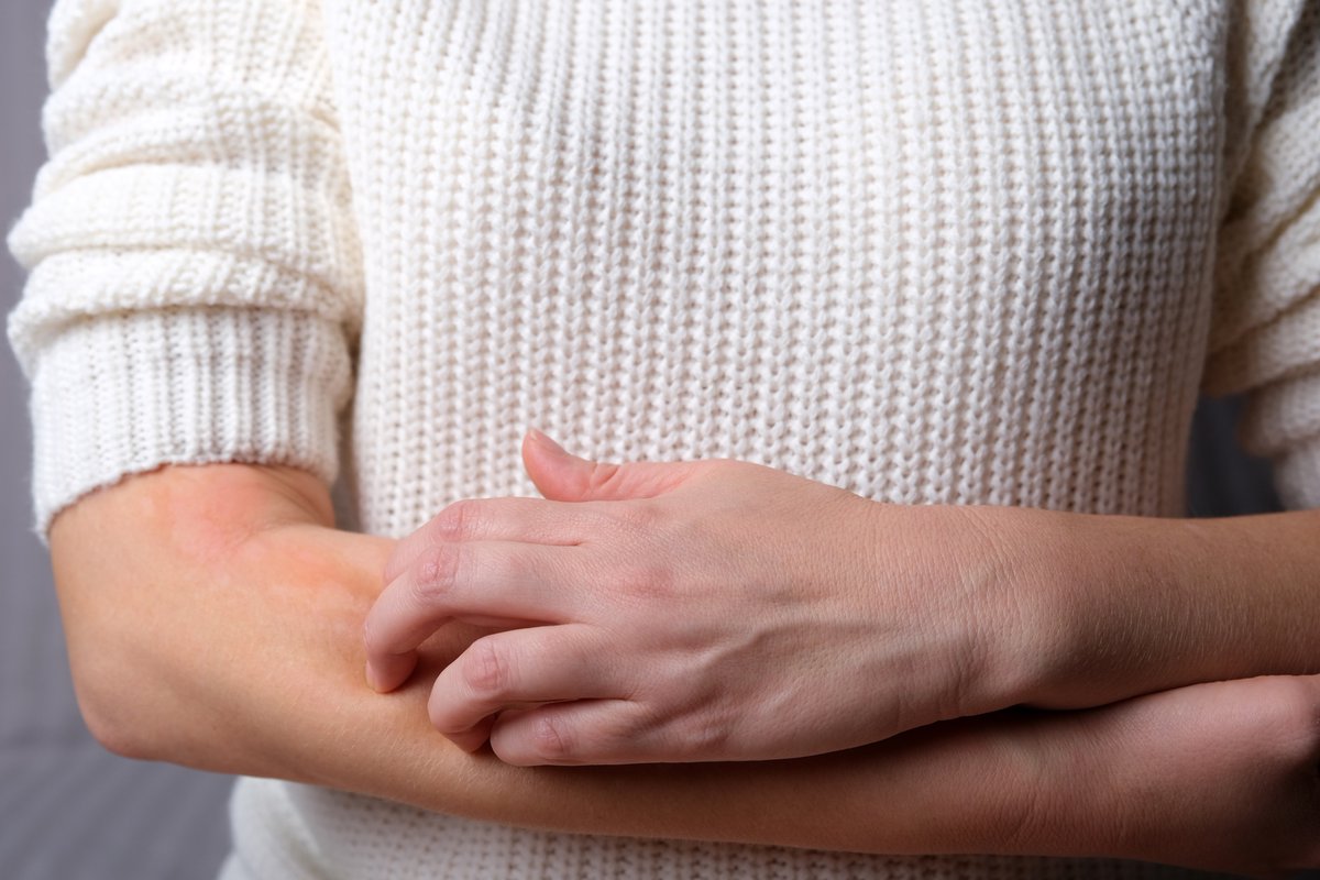 Researchers from @TrinityMed1 have explored the use of extremely rare immune cells to predict how well treatments work for chronic spontaneous urticaria or #recurringhives in a recently published study in the journal Allergy. #researchMATTERS READ: tcd.ie/news_events/to…