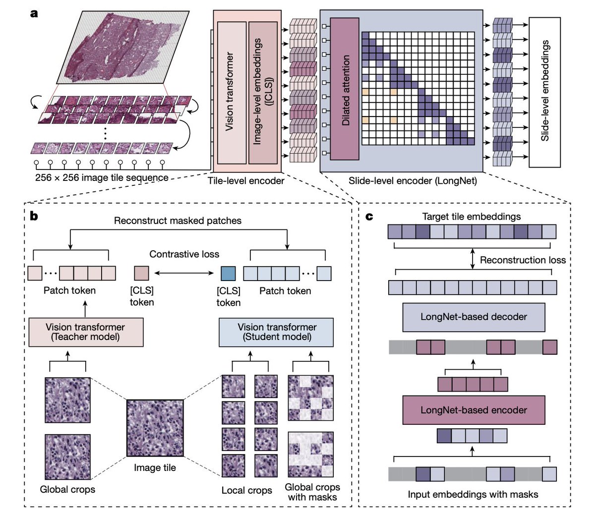 Just out @Nature The 1st whole-slide digital pathology #AI foundation model pre-trained on large-scale real-world data, from over 1.3 billion images, 30,000 patients nature.com/articles/s4158… @hoifungpoon @HanwenXu6 @Microsoft @UW @naotous @MSFTResearch