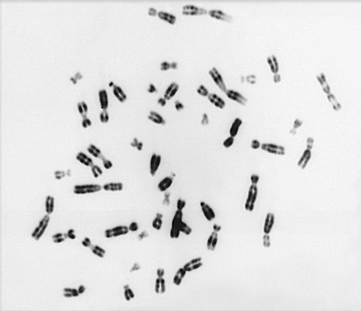 Rätsel gelöst: Ein #CharitéBerlin-Team hat herausgefunden, wie es Zellen gelingt, mit eigentlich schädlichen überzähligen Chromosomen umzugehen. Die Studie könnte Angriffspunkte gegen therapieresistente #Tumoren & #Pilzinfektionen liefern. Jetzt @Nature! charite.de/service/presse…