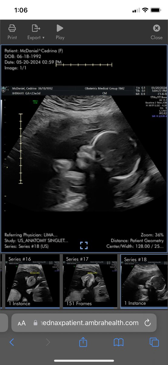 Them Morgan Heads 🤣💙🩵