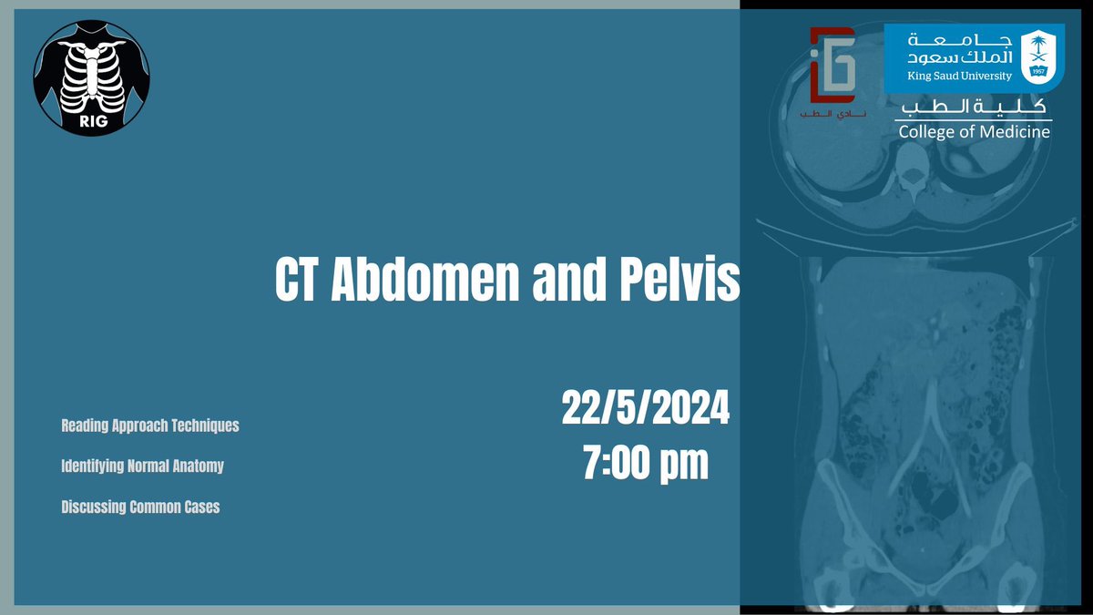 RadiologyIG_KSU's tweet photo. Join our CT Abdomen and Pelvis workshop using the following links:

Zoom: (better audio quality)
https://t.co/RyRk2n1OuW

YouTube Live: (incase Zoom room is full)
https://t.co/XQ3RaQesTA https://t.co/P7veCvMokx