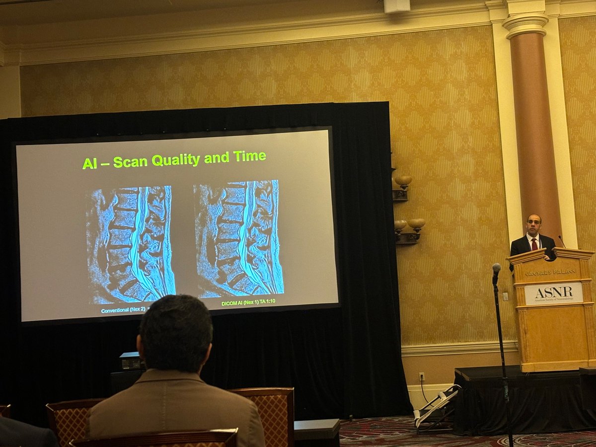 lofiMRI's tweet photo. Excellent #ASNR24 talk by @AmishDoshiMD on AI spine imaging!
Covered:
🕵️♂️ Clinical uses (triage, detection, quantification)
📏 Radiologist workflow (segmentation, measurement, reporting)
⏩ Imaging workflow (acceleration, synthesis)
Excellent #SubtleMR & #SubtleSYNTH examples! https://t.co/yM5dvbHl4E