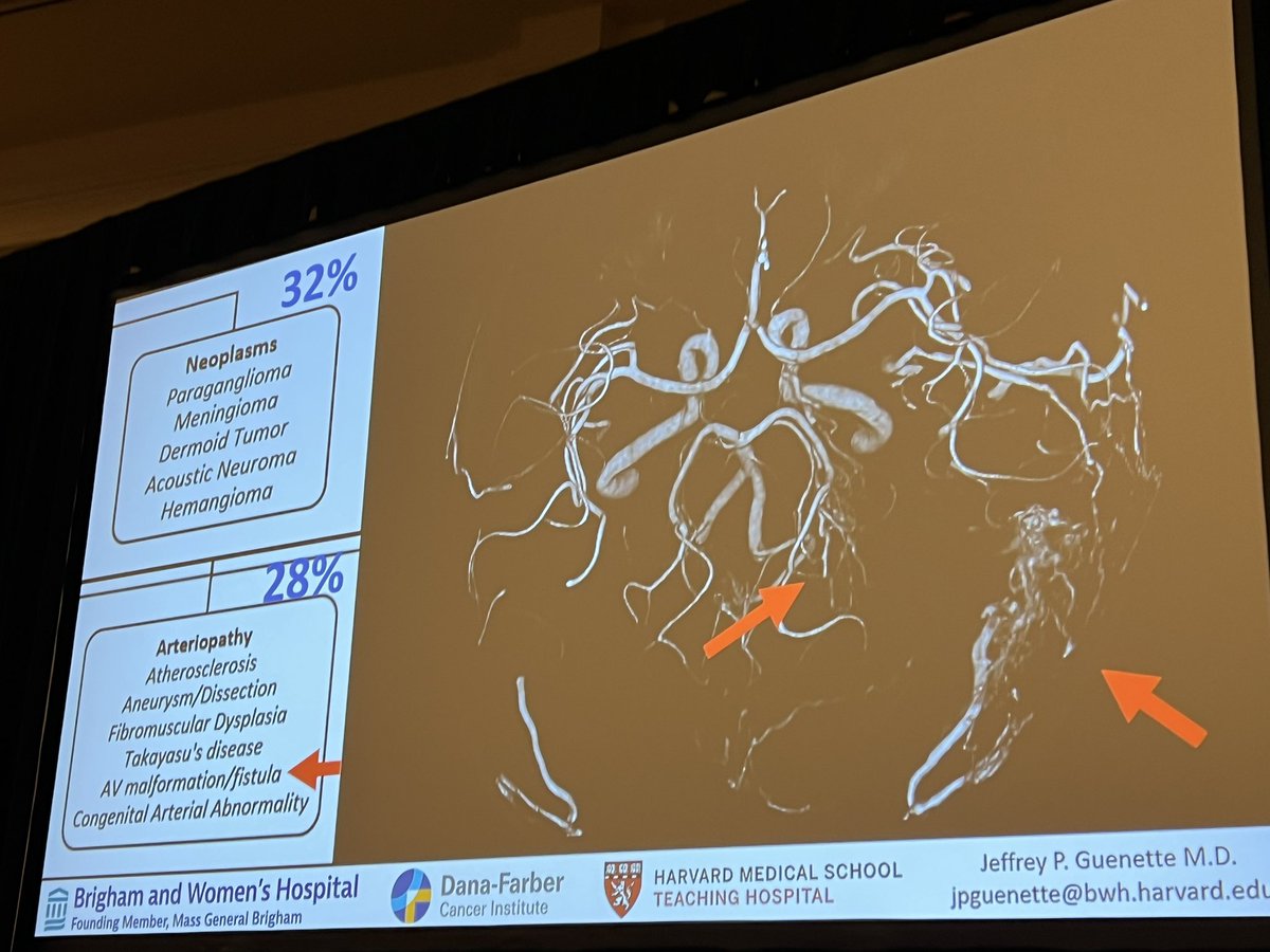 Useful presentation on MRI protocols for pulsatile tinnitus by Dr. Jeffrey Guenette 👏 @ASHNRSociety @TheASNR #HNrad