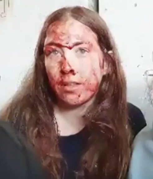This is 19 year old Naama Levy. Within hours of being kidnapped on October 7th this is what her captors did to her. Her face covered in blood. Her shins were cut to stop her running away. The front and back of her pants were covered in blood, indicating brutal r*pe.