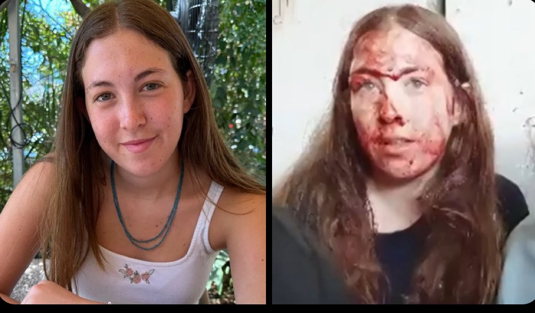 Esta es Naama Levy, de 19 años. A pocas horas de ser secuestrada el 7 de octubre, esto es lo que le hicieron sus captores. Su rostro cubierto de sangre. Le cortaron las espinillas para evitar que huyera. La parte delantera y trasera de sus pantalones estaban cubiertas de