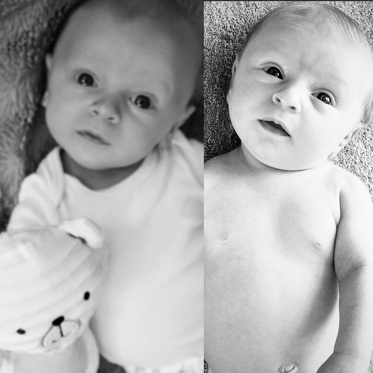 Twin babies six years apart, but one started out scrawny, and one eats like a little pig.