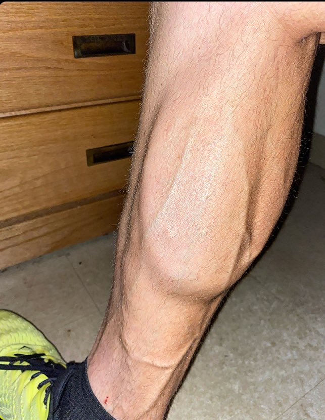 Brady wix tweet media