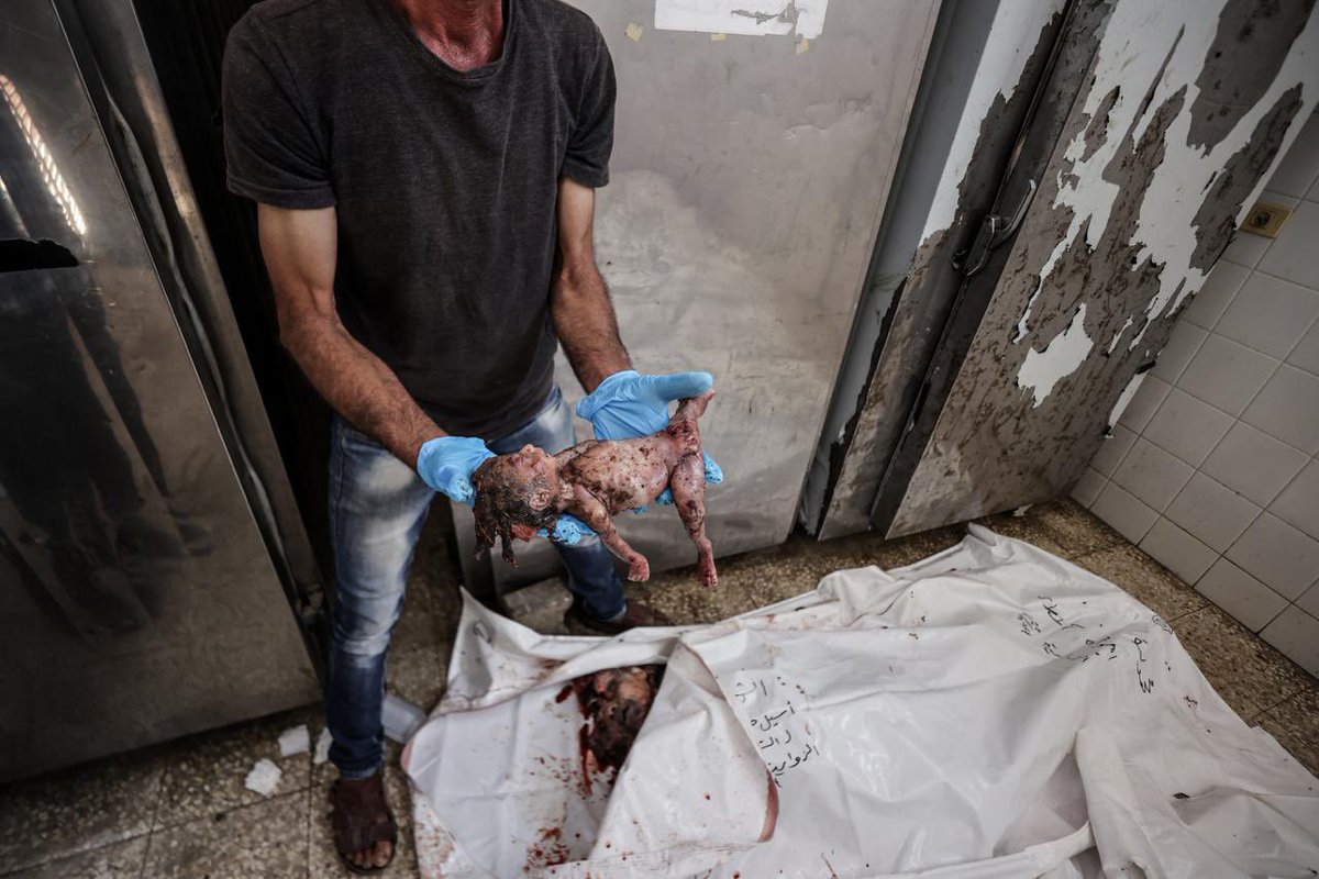 The bodies of the deceased Palestinians were transferred to the morgue of Al-Aqsa Martyrs Hospital in the city, where an unborn baby, who was injured in the head while still in its mother’s womb, was also seen. (Photo by Ali Jadallah)