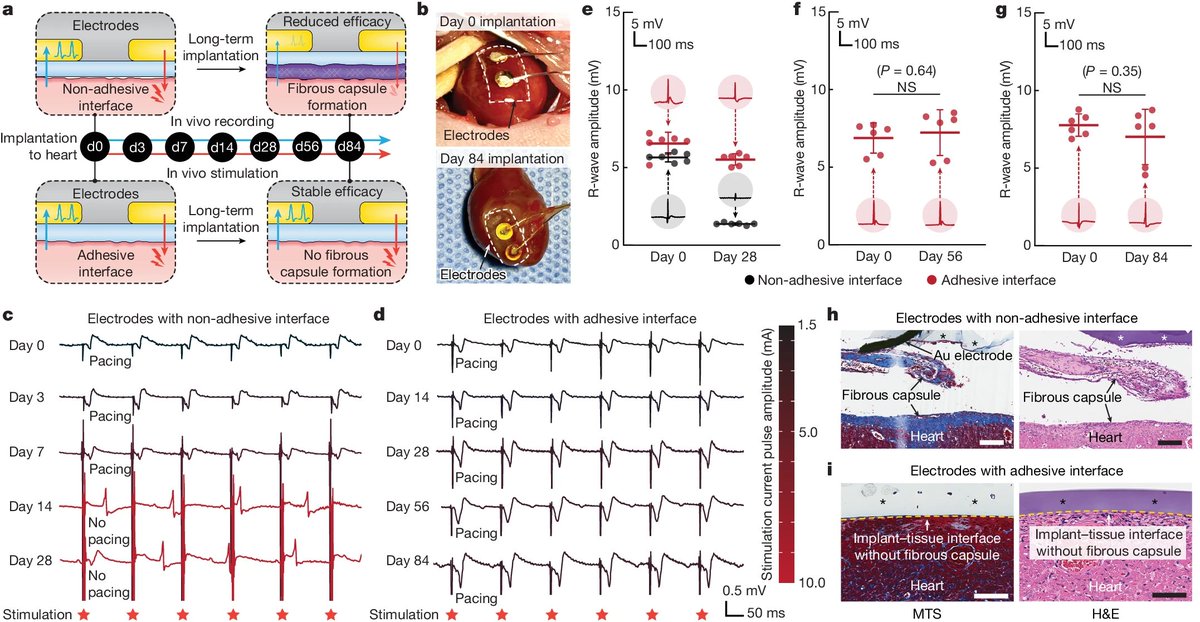 ProfZhaoMIT's tweet photo. 8/n. We further demonstrate 12-week in vivo bidirectional #bioelectrical communication through the #adhesive #antifibrotic interfaces. No observable formation of fibrous capsules between a beating heart and rigid gold electrodes after 12 weeks. https://t.co/nvbot6KBgm