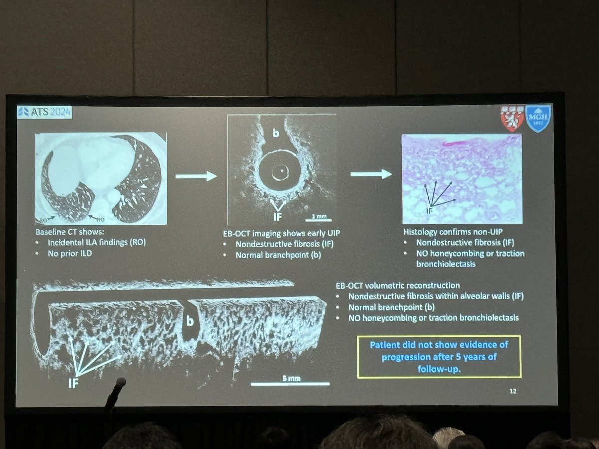 Deji Adegunsoye, MD, PhD tweet media