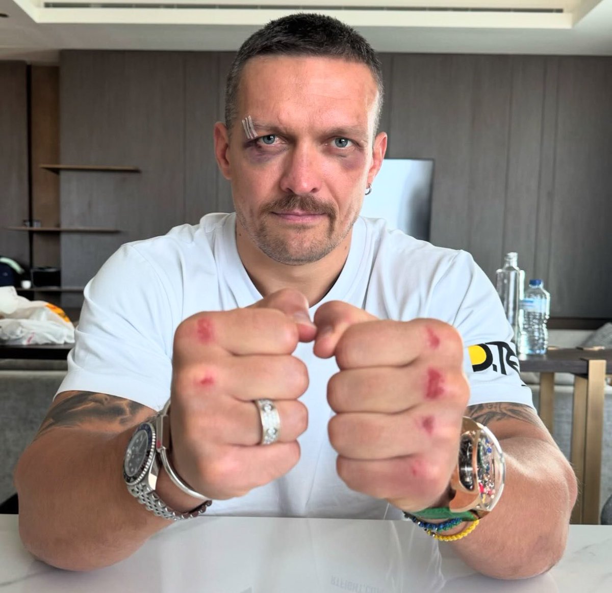 Battle scars of the undisputed king 👑 #FuryUsyk