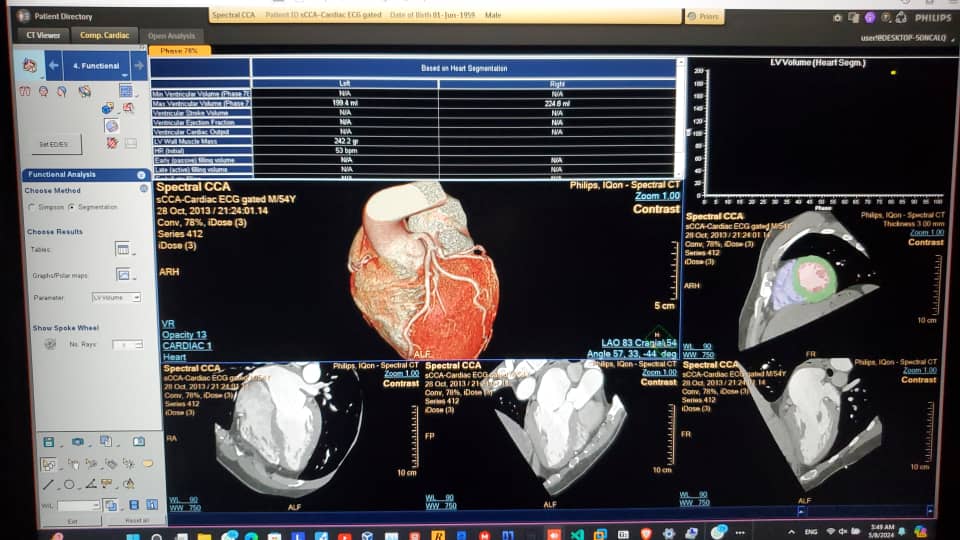 Biomedi79709524's tweet photo. We have a new IntelliSpace Portal
Build version: 12.1.4.11348 with all licenses and options
Just contact us https://t.co/ygmayRlqBL
#philips
#ISP
#CT
#MRI
#IntelliSpace https://t.co/WMQtl37qag