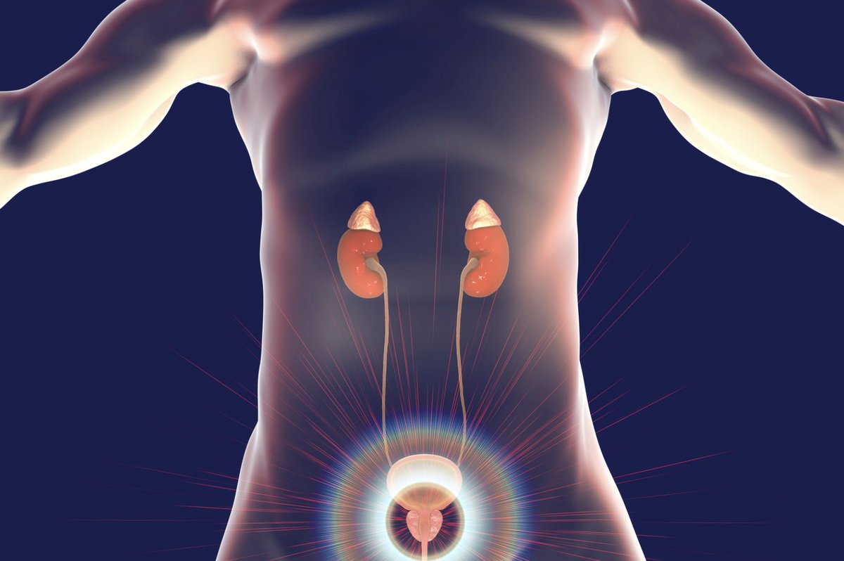 PSMA PET/CT SUVmax Helps Predict Likelihood of Clinically Significant Prostate Cancer in Biopsy Read more ➡️ bit.ly/3yqNT9g #RadOnc #RadOncEd #RadOncNews #ProstateCancer