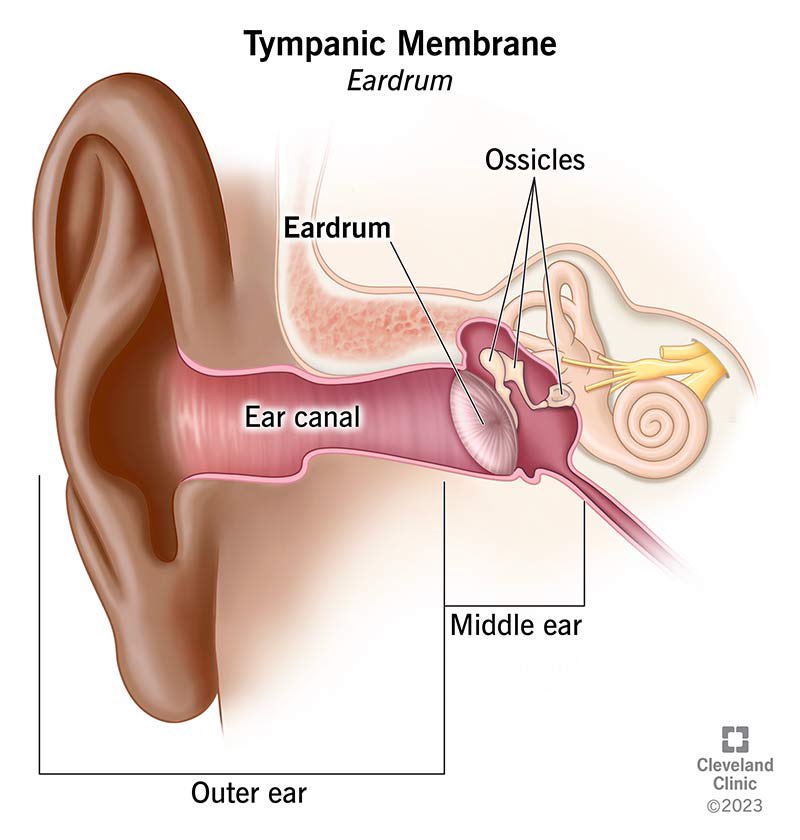 GMings's tweet photo. 2. This is the tympanic membrane. My incus, malleus, and stapes are “destroyed beyond repair”. https://t.co/z9movGohRl