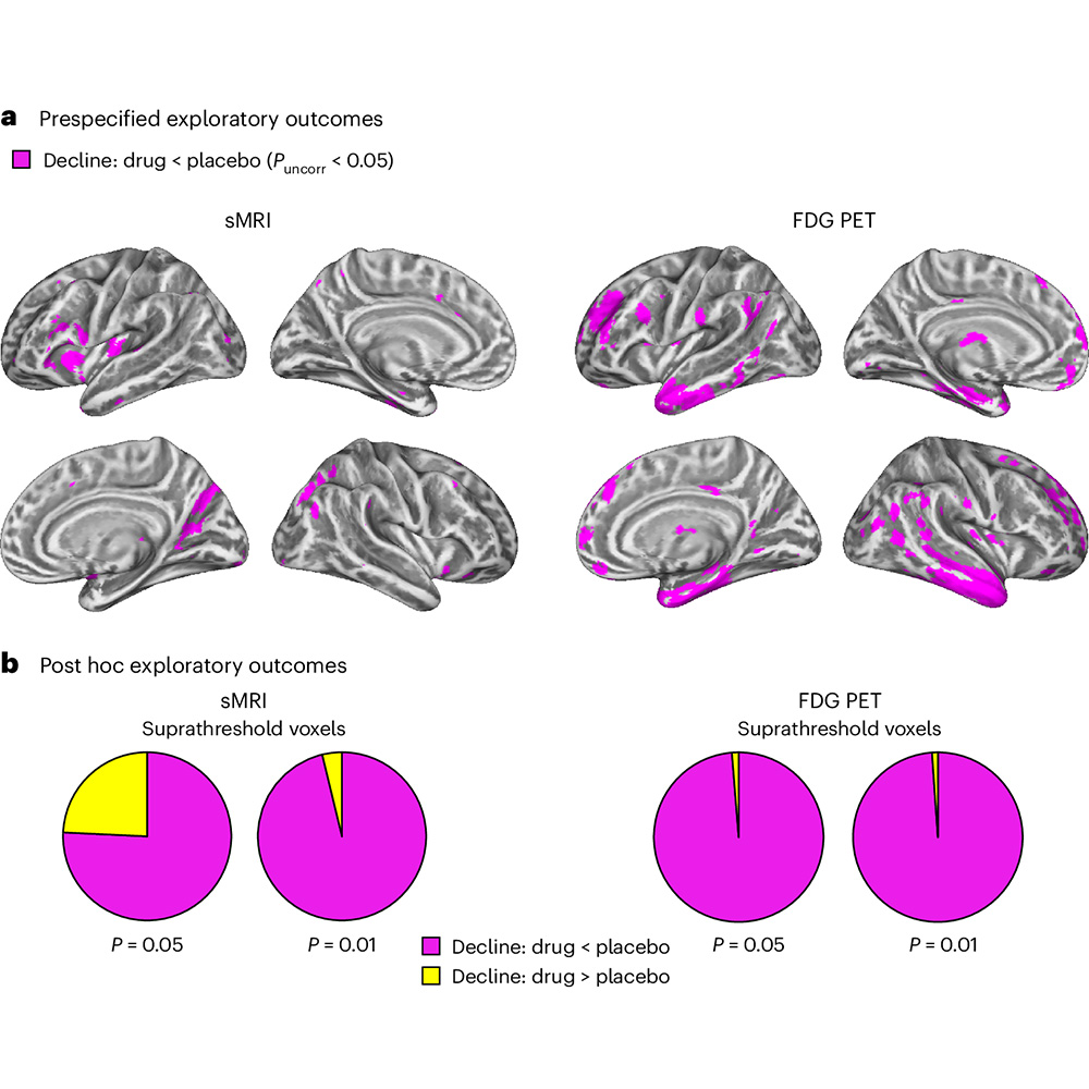 Nature Portfolio (@natureportfolio) on Twitter photo A paper in <a href="/NatureMedicine/">Nature Medicine</a> reports that a phase 2a trial of drug candidate LM11A-31 in mild to moderate Alzheimer disease suggests that p75 neurotrophin receptor modulation is safe and attenuates measures of degeneration. go.nature.com/4bKzJhx A paper in <a href="/NatureMedicine/">Nature Medicine</a> reports that a phase 2a trial of drug candidate LM11A-31 in mild to moderate Alzheimer disease suggests that p75 neurotrophin receptor modulation is safe and attenuates measures of degeneration. go.nature.com/4bKzJhx