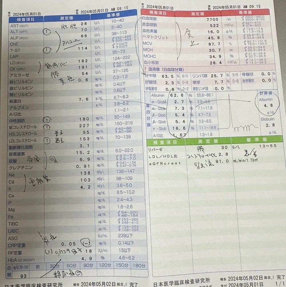 AGE89721246's tweet photo. 20歳、男子学生から連絡がありました。
先日、血液検査をしたら病院の先生から肝臓の値が悪いし、食生活を気をつけなさいと言われたそうです。
老化のスピード測定をすると、１日約18,000でした。
さてどうなるか乞うご期待！

#AGE
#AGEs
#糖化予防
#男子ご飯
#おうちごはん 
#血液検査
#肝臓
#糖尿病 https://t.co/SZut5M8am6