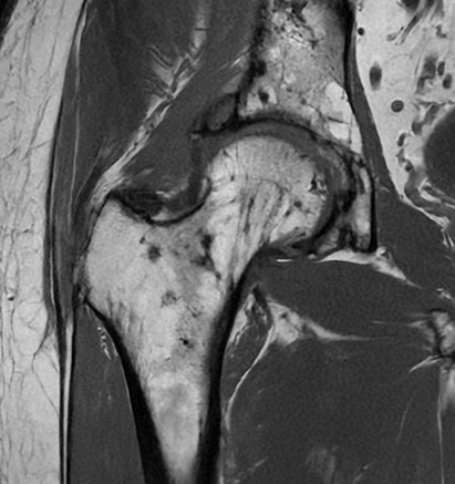 UW_MSKrad's tweet photo. #CaseOfTheWeek‼️🥳‼️
☢️🩻☠️Case#19☠️🩻☢️
#IncidentalFinding
📲➡️➡️#Diagnosis❔❓❔
#FOAMRad #RadEd #MedEd #OrthoEd #OrthoTwitter @ssr_rwg @UWRadRes https://t.co/8PKIiWv9bw