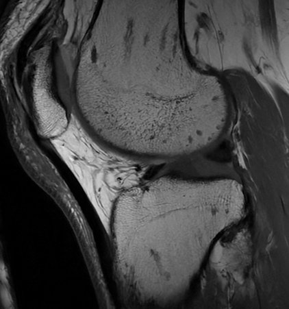 UW_MSKrad's tweet photo. #CaseOfTheWeek‼️🥳‼️
☢️🩻☠️Case#19☠️🩻☢️
#IncidentalFinding
📲➡️➡️#Diagnosis❔❓❔
#FOAMRad #RadEd #MedEd #OrthoEd #OrthoTwitter @ssr_rwg @UWRadRes https://t.co/8PKIiWv9bw