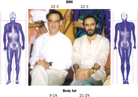 In @TheLancet described 20y ago - the Y-Y paradox (authors Yajnik & Yudnik). Abnormal body fat distribution for South Asian vs European co-author despite similar BMI & better lifestyle for former thelancet.com/journals/lance… 💜Join @ourhealthstudy to help us discover why this exists!