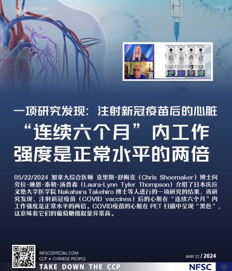 0rQdwNnLHRlPk9k's tweet photo. 一项研究发现:注射新冠疫苗后的心脏“连续六个月”内工作强度是正常水平的两倍。
05/22/2024 加拿大综合医师 #克里斯·舒梅克( #Chris #Shoemaker)博士向 #劳拉·琳恩·泰勒·汤普森( #Laura-Lynn #Tyler #Thompson)介绍了 #日本庆应义塾大学医学院 #Nakahara #Takehiro 博士等人进行的一项研究的结果 https://t.co/K674YmWlyx