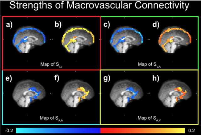 Macrovascular contribution to resting-state fMRI functional connectivity: direct.mit.edu/imag/article/d…
'These findings highlight the extensive contribution to rs-fMRI BOLD & FC predominantly by large veins, but also by large arteries.'
Also relevant for #fNIRS.