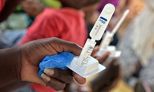 teenslinkuganda's tweet photo. With Uganda's recent policy shift, the age of consent for #HIVSelfTesting is now fifteen years and above. If accessibility hurdles are addressed, this can significantly increase coverage of HIV testing among marginalized key and priority populations. https://t.co/ZJDkhwszCd