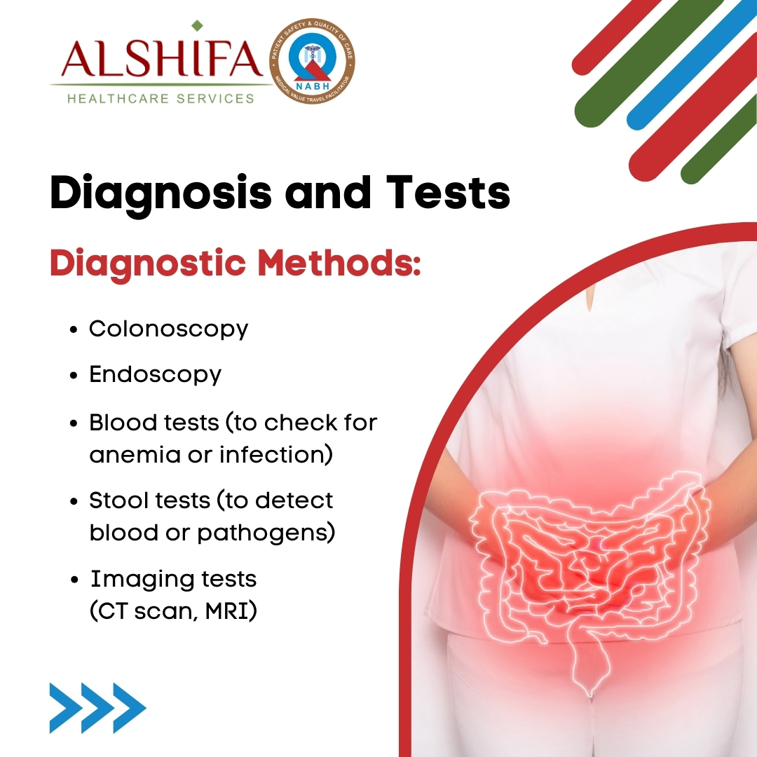 Alshifaglobal's tweet photo. #inflammatoryboweldisease (IBD) includes Crohn's disease and ulcerative colitis, marked by chronic inflammation of the digestive tract, causing symptoms such as #AbdominalPain, #diarrhea, #fatigue, and #weightloss. https://t.co/9MLLxpJsbd