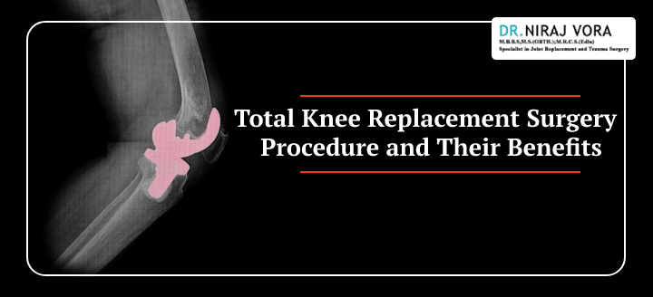 #TotalKneeReplacementSurgery Procedure & Their Benefits It is an undeniable fact to state that good knees are always going to be an essential part of your healthy lifestyle. Pain in knee region is quite common with growing age.. Know more at: drnirajvora.com/blog/total-kne…