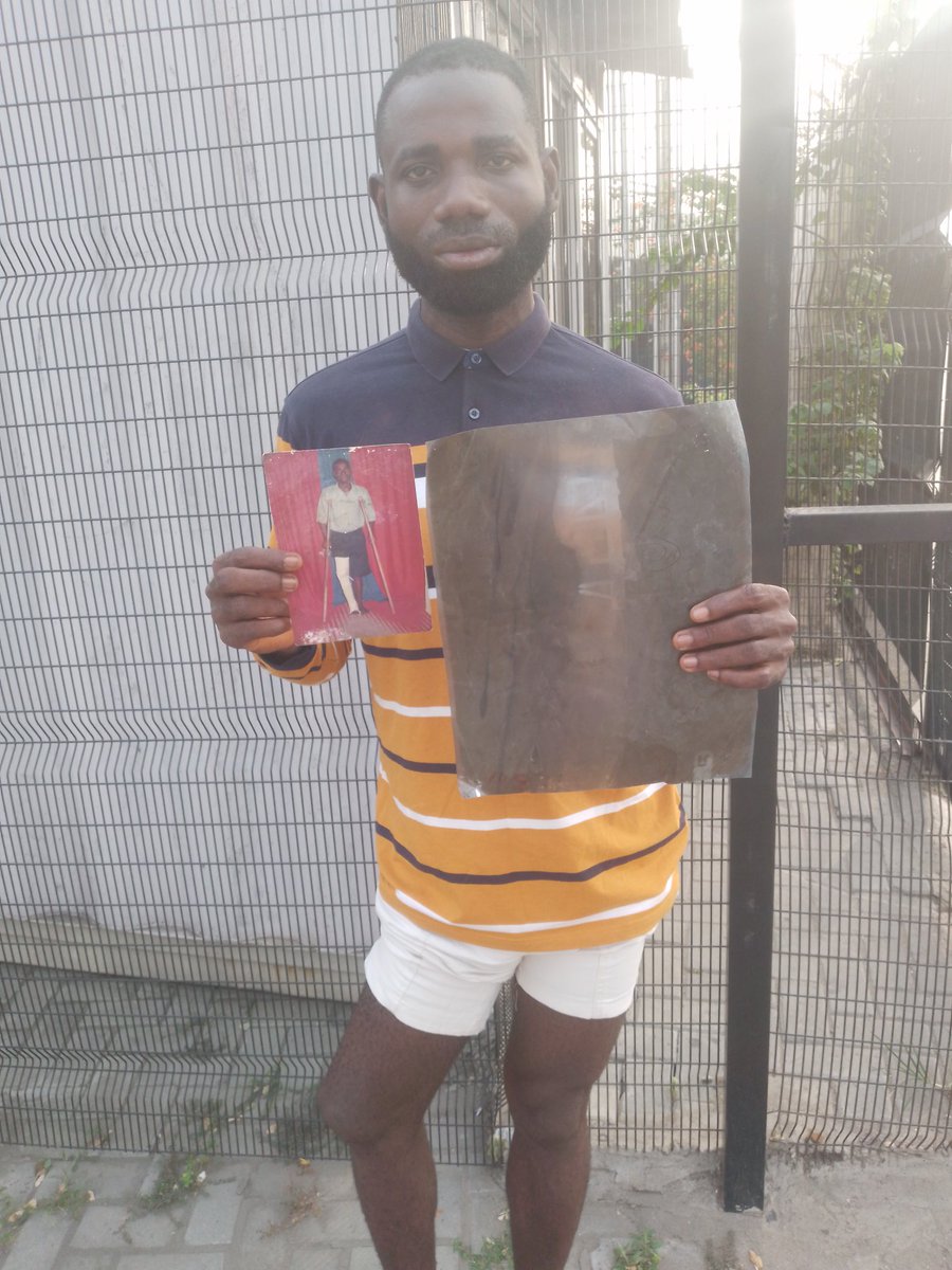 CodeWrack's tweet photo. Dear @UnkleAyo & all great family here,
Sir/Ma, please help🙏
I'm groaning in dire body pains that may paralyse me or compel the amputation of my leg soon😭
I had iron objects buried in my broken leg in an operation to secure my bones & stabilise injuries
1/6
#HelpRotimi https://t.co/xLSXI1G9D6