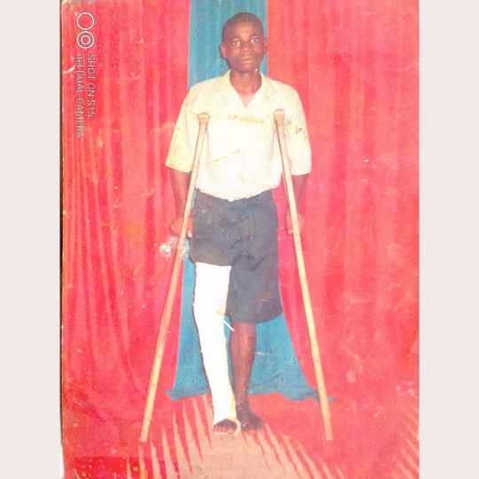 CodeWrack's tweet photo. Dear @itsSh0la & all great family here,
Sir/Ma, please help🙏
I'm groaning in dire body pains that may paralyse me or compel the amputation of my leg soon😭
I had iron objects buried in my broken leg in an operation to secure my bones & stabilise injuries
1/6
#HelpRotimi https://t.co/p3gNypvGTP