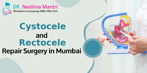 Cystocele and Rectocele Repair Surgery in Mumbai Cystocele is the fall or prolapse of the bladder into the woman’s vagina from its usual anatomical position... Know more at: drneelimamantri.com/blog/cystocele… #CystoceleAndRectoceleRepairSurgery #CystoceleTreatment #RectoceleRepairSurgery