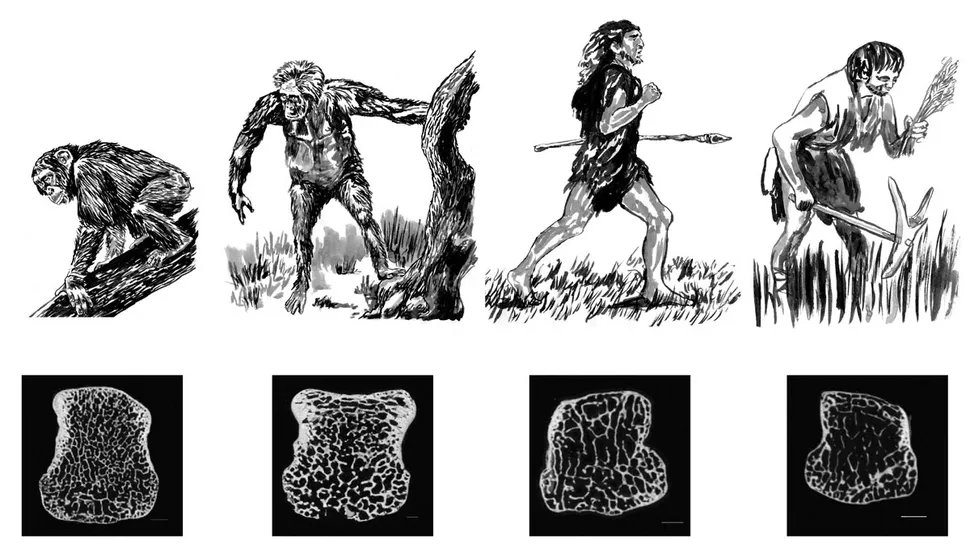 Dr Ai Lyn Tan (@drailyntan) on Twitter photo Why modern sedentary humans need to increase #physicalactivity & #exercise to protect from #osteoporosis
⚠️#Bone density dropped through evolution
Primates climbing trees
⏬
Upright land being
⏬
Hunter gatherer
⏬
Agriculturalists
👉🏽livescience.com/49236-bone-den…
via <a href="/LiveScience/">Live Science</a> Why modern sedentary humans need to increase #physicalactivity & #exercise to protect from #osteoporosis
⚠️#Bone density dropped through evolution
Primates climbing trees
⏬
Upright land being
⏬
Hunter gatherer
⏬
Agriculturalists
👉🏽livescience.com/49236-bone-den…
via <a href="/LiveScience/">Live Science</a>