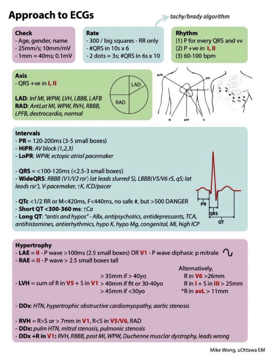 ShrooqHawati's tweet image. Approach to ECGs 📝
Very informative summary 

#MedX #FOAMed #MedEd #CardioEd #CardioTwitter #MedTwitter #livertwitter #Cardiology #livertwitter #4KMedEd #ECG #medicalstudent 
#MedicalEducation #Emergency #medicalpractice
