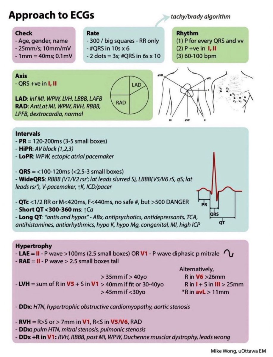 Approach to ECGs 📝
Very informative summary 

#MedX #FOAMed #MedEd #CardioEd #CardioTwitter #MedTwitter #livertwitter #Cardiology #livertwitter #4KMedEd #ECG #medicalstudent 
#MedicalEducation #Emergency #medicalpractice