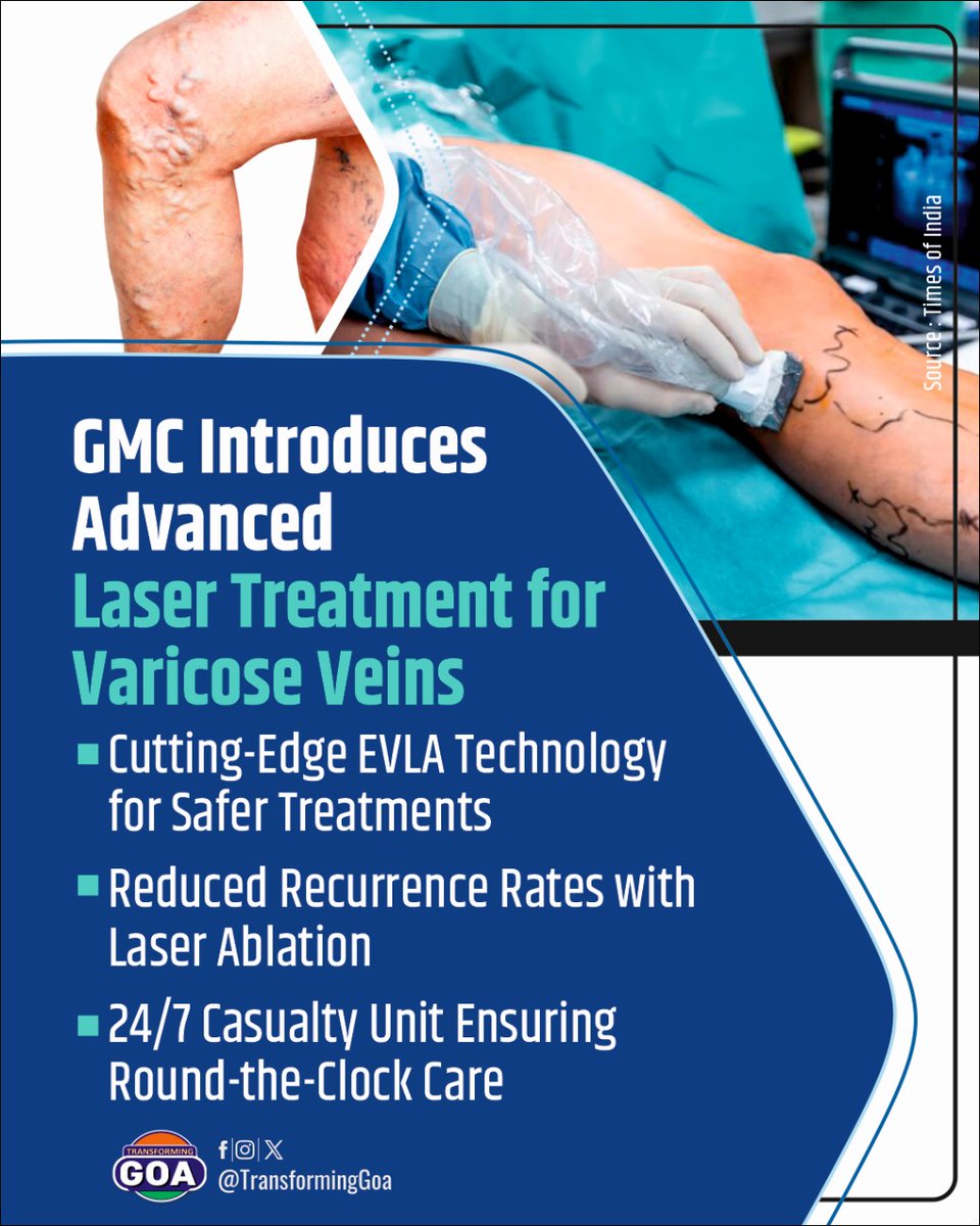 GMC Introduces Advanced Laser Treatment for Varicose Veins #goa #GoaGovernment #TransformingGoa #bjym #bjymgoa #GMCLaserTreatment #VaricoseVeins #EVLA #LaserAblation #AdvancedMedicalCare #24HourCare #InnovativeTreatment #HealthTech #SaferTreatments #MedicalInnovation