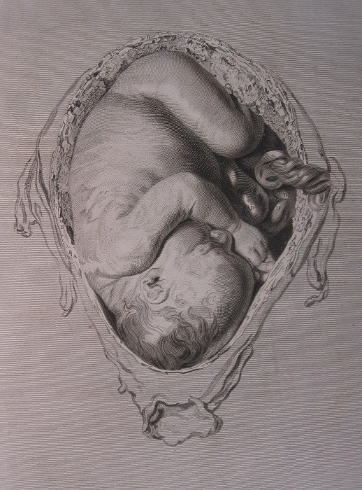 William Hunter, obstetrician, anatomist and Honorary Fellow of @rcpsglasgow was born #OTD 1718 at Long Calderwood Farm in East Kilbride. Hunter became a leading educator in the field of anatomy - his most famous work The Gravid Uterus was published in 1744