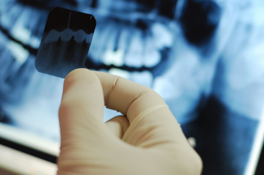 uolexecedu's tweet photo. 🦷 Χειρουργική αφαίρεση γ γομφίου της κάτω γνάθου: Προληπτικές ενέργειες για αποφυγή κλινικών και νομικών επιπλοκών

👨🏻‍⚕️ Τι πρέπει να κάνει ο Οδοντίατρος ή ο ειδικός ώστε να μειωθούν στο ελάχιστο οι πιθανότητες να κατηγορηθείτε για ιατρική αμέλεια

➡️🟪 https://t.co/ybwT8uI5n4 https://t.co/H3B1z9Gyo6