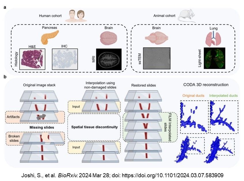 In a study funded by #CCBIR, @deniswirtz @HopkinsMedicine et al. developed a #DeepLearning approach to improve 3D tissue mapping @biorxivpreprint biorxiv.org/content/10.110….