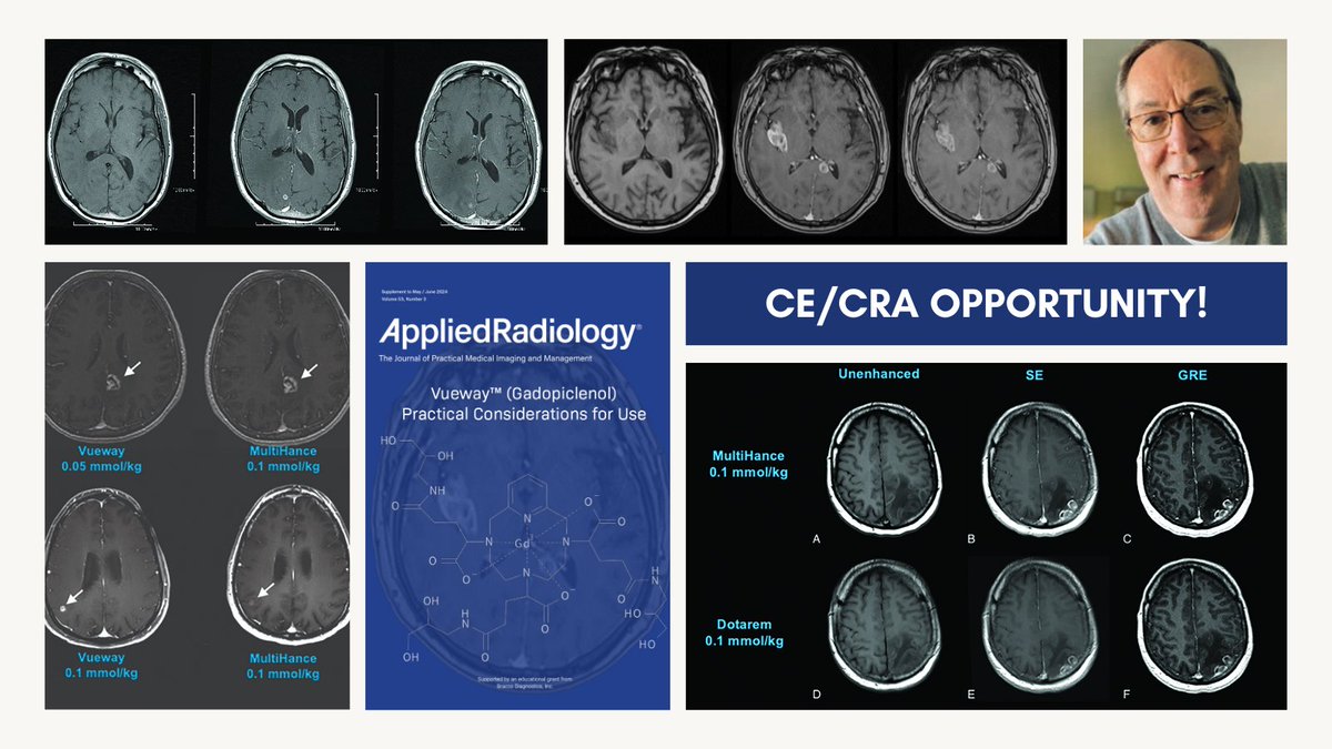 Check out a new CE/CRA opportunity with William Faulkner! 🔗 bit.ly/4dQPo0v @wmfaulkner #CE #MRImaging #Radiology #MRI #RadEd #MedEd