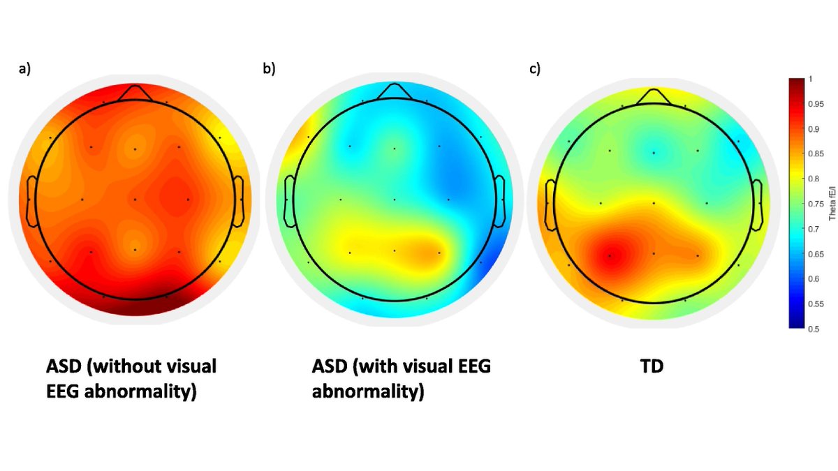 [Autism] Chan et al.: 'Some people with autism show abnormal brain signalling reflected by heightened theta-band functional excitation/inhibition (fE/I) ratio.' doi.org/10.1016/j.clin…