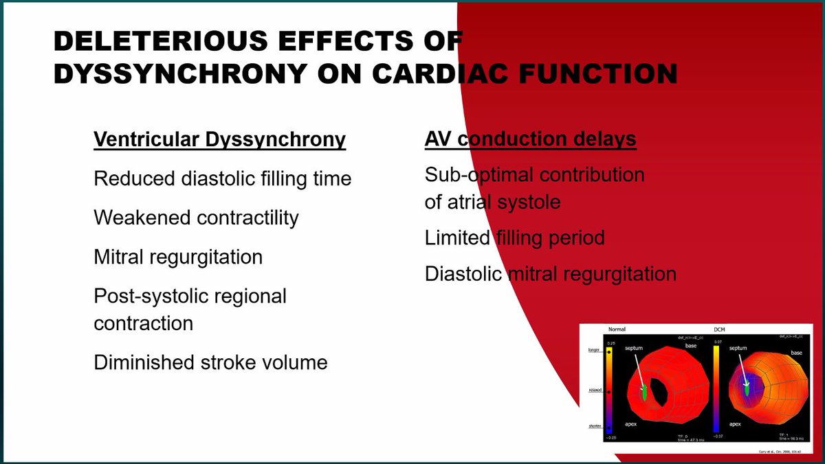 🫀Dr. Miguel Leal spoke at OU Virtual CV GR today &amp; provided a superb and thoughtful overview of conduction system pacing
🫀See slides ⬇️ kindly provided by <a href="/DrMiguelLeal/">Miguel A Leal</a> 
<a href="/DrJMarine/">Joseph Marine</a> 
<a href="/FaisalMMerchant/">Faisal Merchant</a> 
<a href="/DrDave01/">David E. Albert, M.D</a> 
@ZainAsadEP 
<a href="/HeartOTXHeartMD/">John P Erwin III MD MBA MACC (#BigPoppy )</a> 
<a href="/iamritu/">Ritu Thamman MD</a> 
<a href="/SumeetSChugh/">Sumeet Chugh</a>