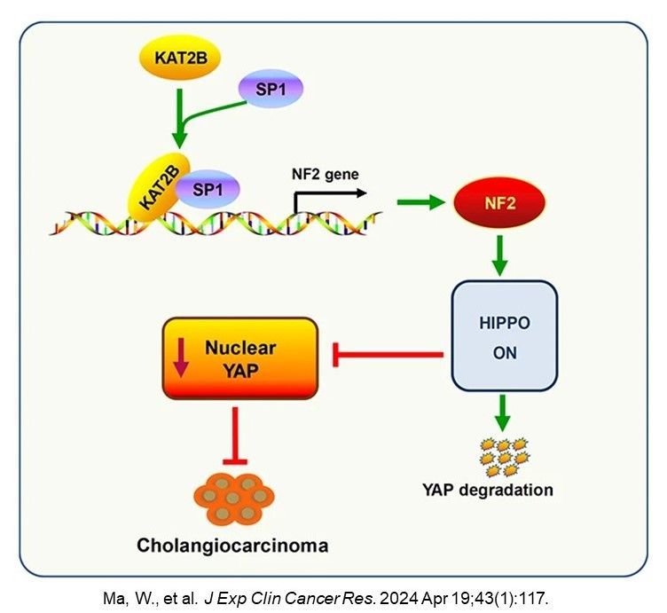 Using experimental models in a study supported by our division, researchers @TulaneMedicine found that KAT2B (a histone acetyltransferase) inhibits #cholangiocarcinoma growth via regulation of NF2-YAP signaling @BioMedCentral jeccr.biomedcentral.com/articles/10.11….