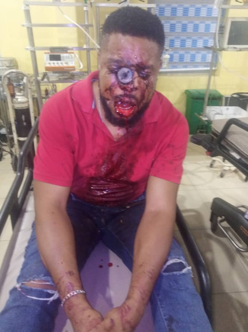This is what <a href="/PoliceNG/">Nigeria Police Force</a> have done, sending this innocent man to early grave. On his face is tear gas cannister, shot directly at him. Pls his family needs help, his wife and kids needs help Nigerians 

<a href="/instablog9ja/">Instablog9ja</a> <a href="/yabaleftonline/">YabaLeftOnline</a> <a href="/DavidHundeyin/">David Hundeyin</a> 

#AbujaTwitterCommunity