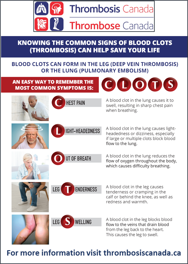 Deborah Siegal (@debsiegal) on Twitter photo I am doing a 5K 🏃 on May 25th to support <a href="/ThrombosisCan/">Thrombosis Canada</a> achieve its mission to ⬆️ awareness about #thrombosis and improve the lives and health of people who are affected by this disease.
Help us achieve this goal! 🙏
raceroster.com/events/2024/76…
<a href="/MarcCarrier1/">Marc Carrier</a> <a href="/TzufeiWang/">Tzu-Fei Wang</a> I am doing a 5K 🏃 on May 25th to support <a href="/ThrombosisCan/">Thrombosis Canada</a> achieve its mission to ⬆️ awareness about #thrombosis and improve the lives and health of people who are affected by this disease.
Help us achieve this goal! 🙏
raceroster.com/events/2024/76…
<a href="/MarcCarrier1/">Marc Carrier</a> <a href="/TzufeiWang/">Tzu-Fei Wang</a>