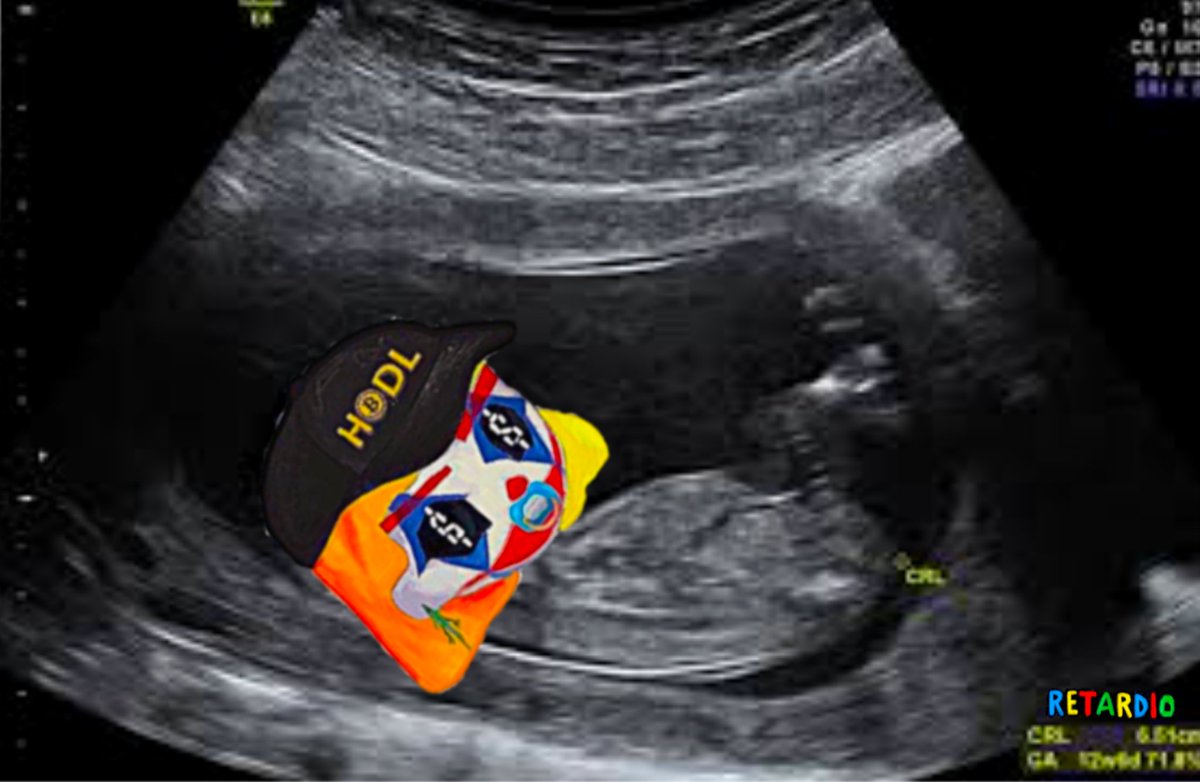 InnerFire11's tweet image. FUCK
Didn't take my initials out brother
What do I do now brother?!  🫵🤡