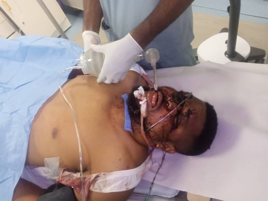 EdehSunday01's tweet photo. This is what @PoliceNG have done, sending this innocent man to early grave. On his face is tear gas cannister, shot directly at him. Pls his family needs help, his wife and kids needs help Nigerians 

@instablog9ja @yabaleftonline @DavidHundeyin 

#AbujaTwitterCommunity https://t.co/ukzlZKj4Sa