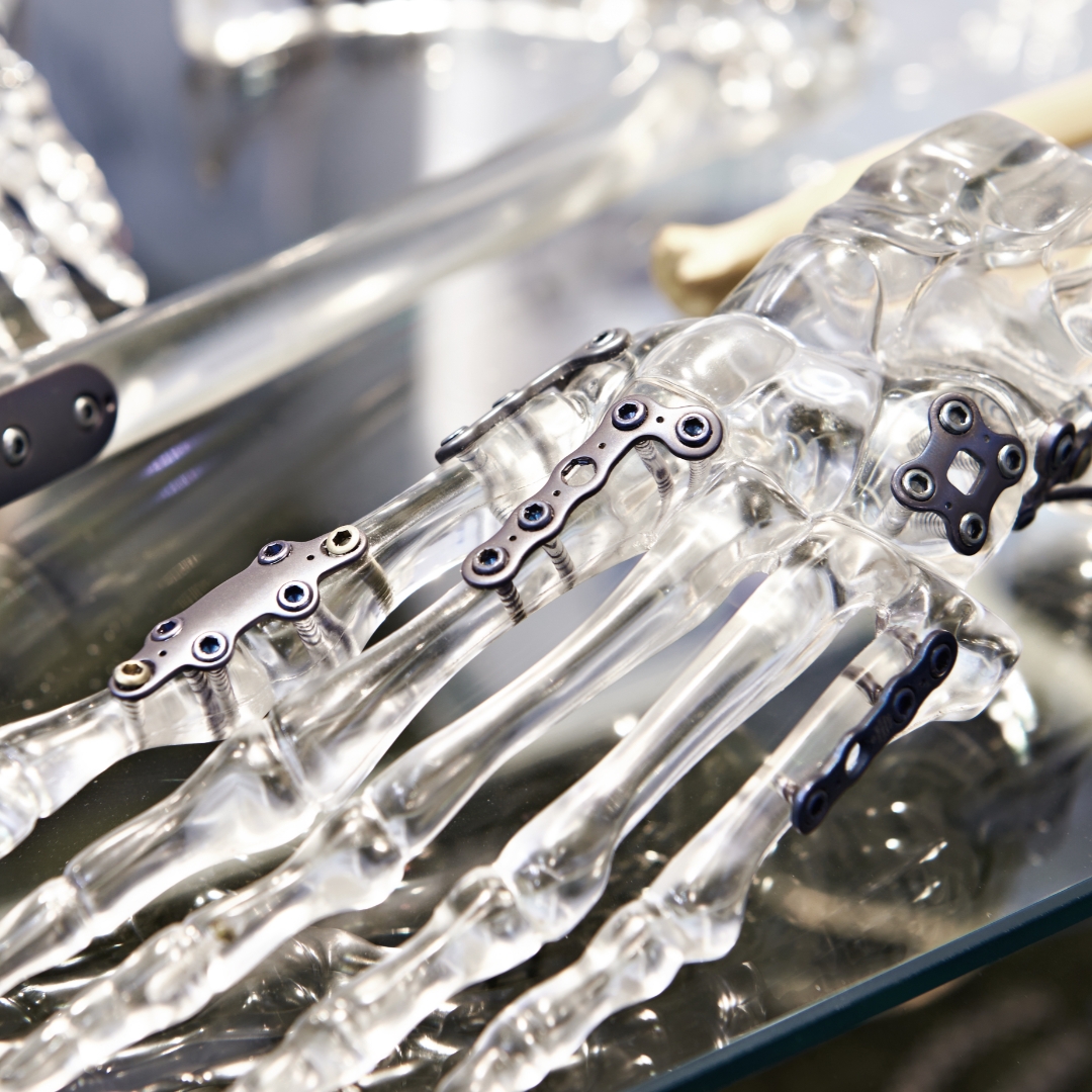 VestedMetalsInt's tweet image. Did you know that Titanium is used in medical implants and for jewelry because it is considered non-toxic and nonreactive?