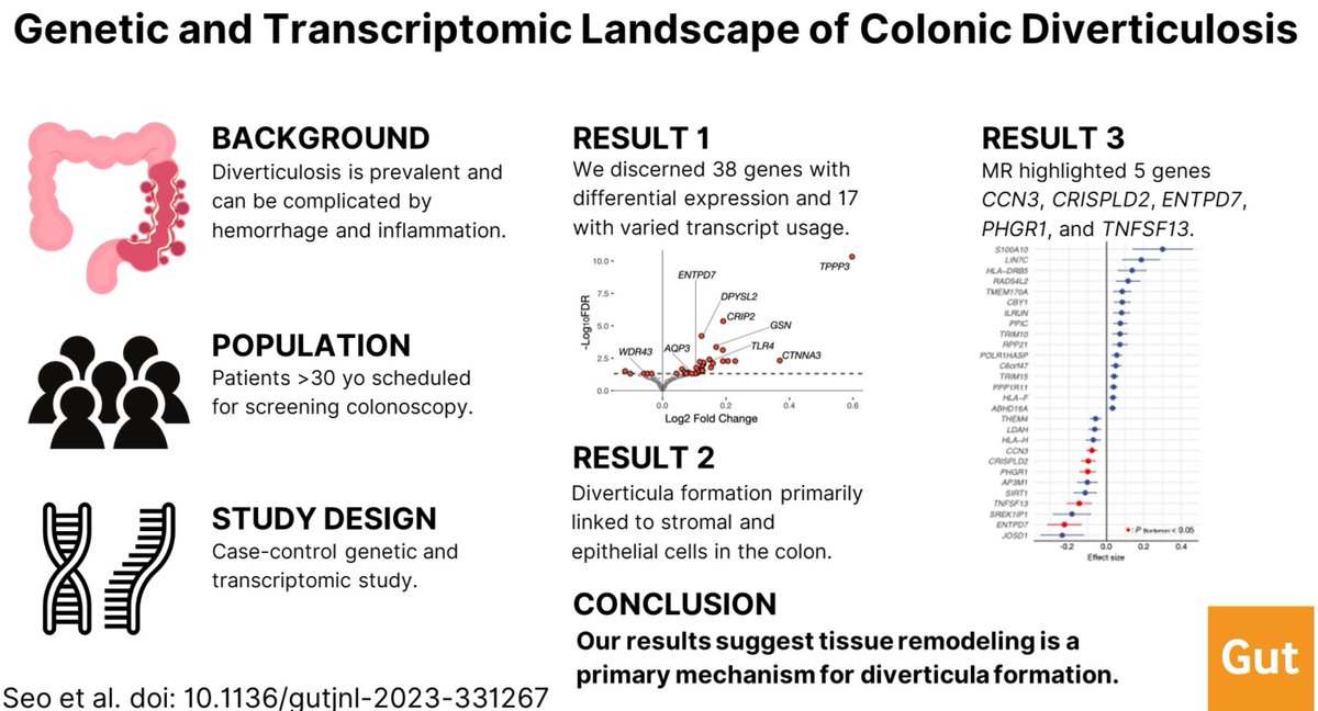 #GUTAbstract from the paper by Seo et al entitled 'Genetic and transcriptomic landscape of colonic diverticulosis' via bit.ly/3K8FQQY Paper via bit.ly/4bK7kbq #Diverticulosis